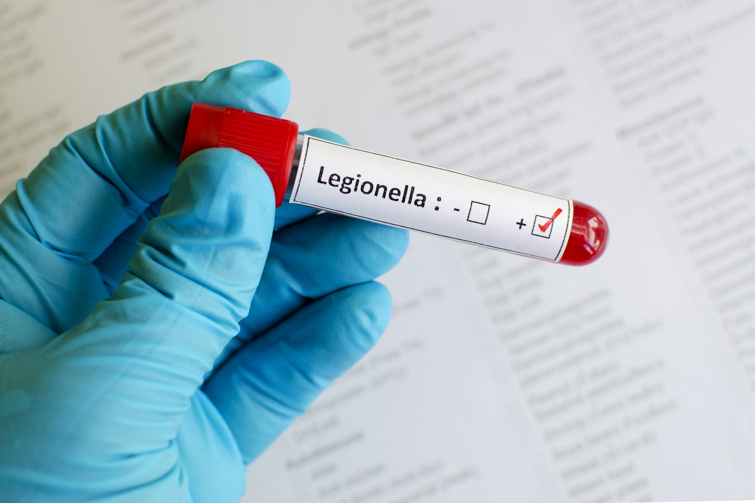 Risiko Legionella: rencana pencegahan, penilaian ulang dan pengendalian diri